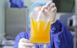 Donor Plasma Darah Konvalesen di PMI Purwakarta Masih Minim, Hanya Ada Dua Labu