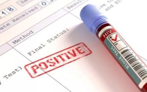 Tahun 2022, Kasus HIV-Aids di Kabupaten Purwakarta Hampir Capai 1000 Orang