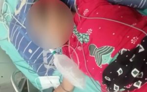 Shintya Jingga Cahyandari, Siswi Yatim Piatu di Purwakarta Ini Menderita Lupus