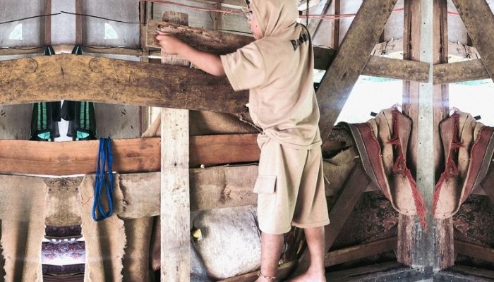 Ikatan Kasih: Kisah Habibi, Bocah Pengidap Hidrosefalus yang Terpaksa Diikat