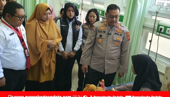 Polres Purwakarta Beri Trauma Healing untuk Balita Korban Kekerasan Ayah Kandung