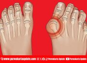 Waspada! Ini 5 Makanan dan Minuman Tinggi Purin yang Picu Serangan Asam Urat